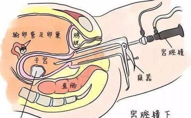 图片 99