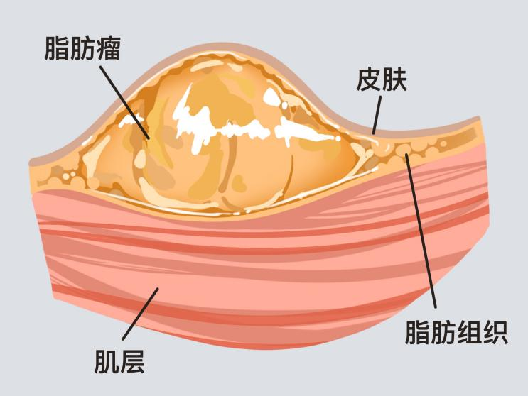 图片 1