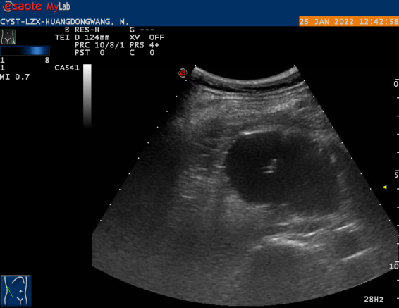 CYST-LZX-HUANGDONGWA[00_00_26][20220807-002510]