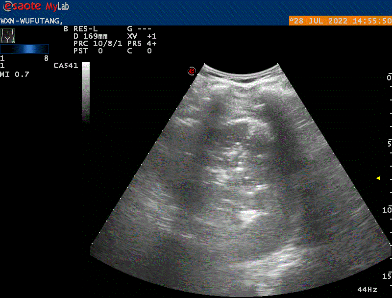 WXM-WUFUTANG_20220728142551_1455504